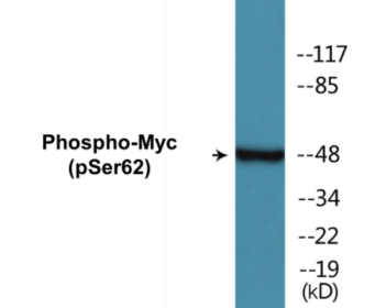 Phospho-Myc (Ser62) Colorimetric Cell-Based ELISA Kit
