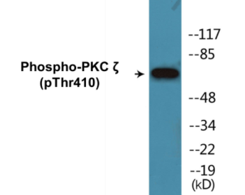 Phospho-PKC zeta (Thr410) Colorimetric Cell-Based ELISA Kit