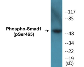 Phospho-Smad1 (Ser465) Colorimetric Cell-Based ELISA Kit