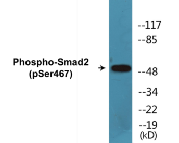 Phospho-Smad2 (Ser467) Colorimetric Cell-Based ELISA Kit