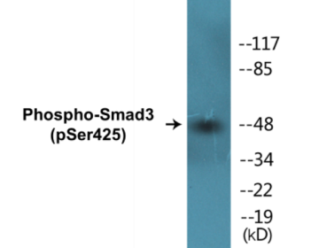Phospho-Smad3 (Ser425) Colorimetric Cell-Based ELISA Kit