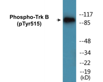 Phospho-Trk B (Tyr515) Colorimetric Cell-Based ELISA Kit