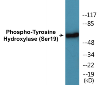 Phospho-Tyrosine Hydroxylase (Ser19) Colorimetric Cell-Based ELISA Kit