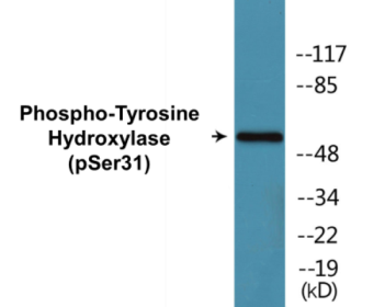 Phospho-Tyrosine Hydroxylase (Ser31) Colorimetric Cell-Based ELISA Kit