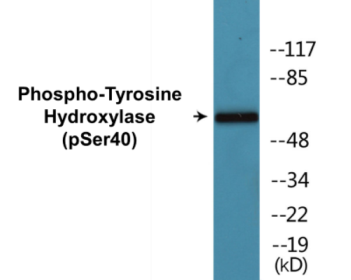 Phospho-Tyrosine Hydroxylase (Ser40) Colorimetric Cell-Based ELISA Kit