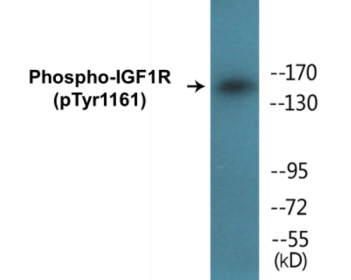 Phospho-IGF1R (Tyr1161) Colorimetric Cell-Based ELISA Kit