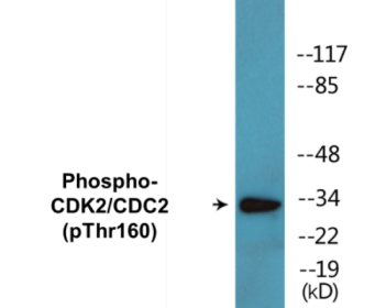 Phospho-CDK2 (Thr160) Colorimetric Cell-Based ELISA Kit