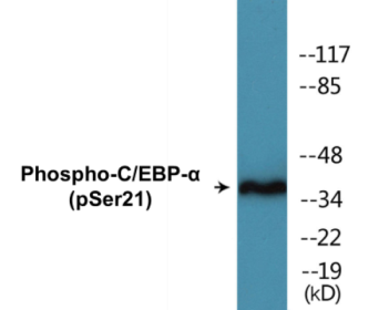 Phospho-C/EBP-alpha (Ser21) Colorimetric Cell-Based ELISA Kit