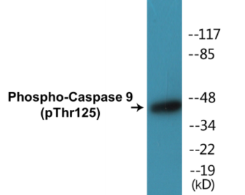 Phospho-Caspase 9 (Thr125) Colorimetric Cell-Based ELISA Kit