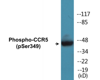 Phospho-CCR5 (Ser349) Colorimetric Cell-Based ELISA Kit