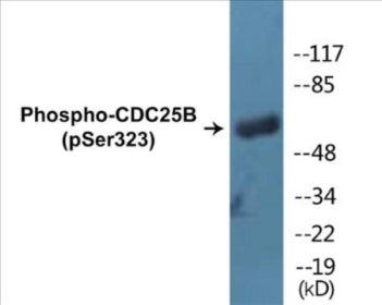 Phospho-CDC25B (Ser323) Colorimetric Cell-Based ELISA Kit