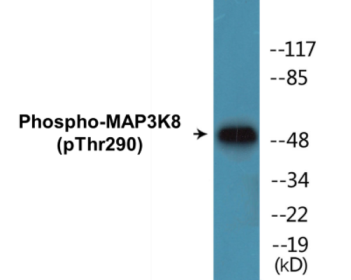 Phospho-MAP3K8 (Thr290) Colorimetric Cell-Based ELISA Kit