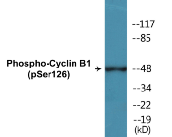 Phospho-Cyclin B1 (Ser126) Colorimetric Cell-Based ELISA Kit