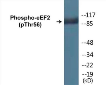 Phospho-eEF2 (Thr56) Colorimetric Cell-Based ELISA Kit