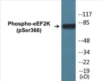 Phospho-eEF2K (Ser366) Colorimetric Cell-Based ELISA Kit