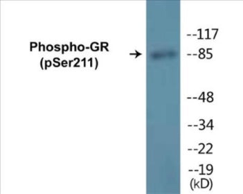 Phospho-GR (Ser211) Colorimetric Cell-Based ELISA Kit