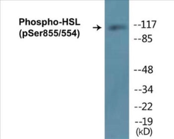 Phospho-HSL (Ser855/554) Colorimetric Cell-Based ELISA Kit