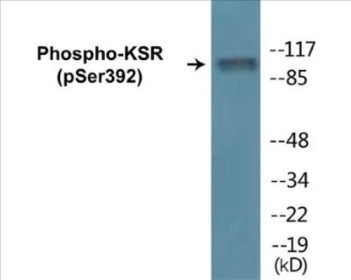 Phospho-KSR (Ser392) Colorimetric Cell-Based ELISA Kit