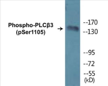 Phospho-PLCbeta3 (Ser1105) Colorimetric Cell-Based ELISA Kit