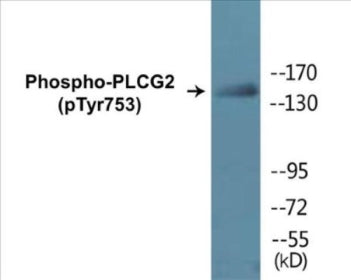 Phospho-PLCG2 (Tyr753) Colorimetric Cell-Based ELISA Kit