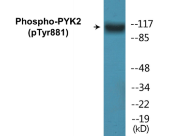 Phospho-PYK2 (Tyr881) Colorimetric Cell-Based ELISA Kit