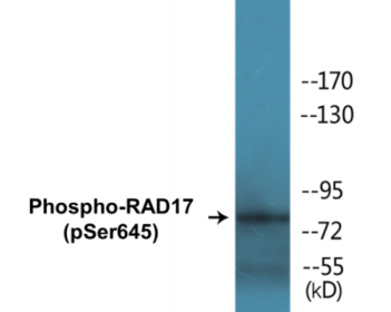 Phospho-RAD17 (Ser645) Colorimetric Cell-Based ELISA Kit
