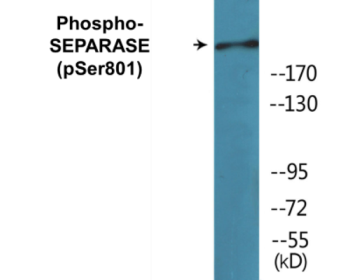 Phospho-SEPARASE (Ser801) Colorimetric Cell-Based ELISA Kit