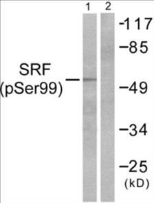 Phospho-SRF (Ser99) Colorimetric Cell-Based ELISA Kit