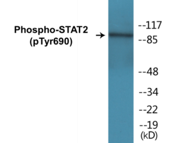 Phospho-STAT2 (Tyr690) Colorimetric Cell-Based ELISA Kit