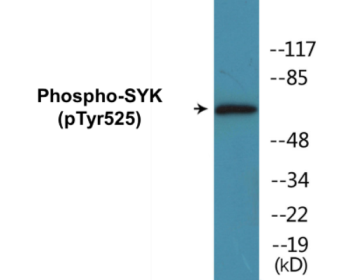 Phospho-SYK (Tyr525) Colorimetric Cell-Based ELISA Kit