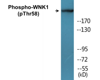 Phospho-WNK1 (Thr58) Colorimetric Cell-Based ELISA Kit