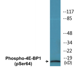 Phospho-4E-BP1 (Ser64) Colorimetric Cell-Based ELISA Kit