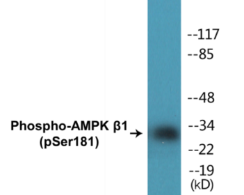 Phospho-AMPK beta1 (Ser181) Colorimetric Cell-Based ELISA Kit