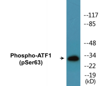 Phospho-ATF1 (Ser63) Colorimetric Cell-Based ELISA Kit