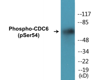 Phospho-CDC6 (Ser54) Colorimetric Cell-Based ELISA Kit