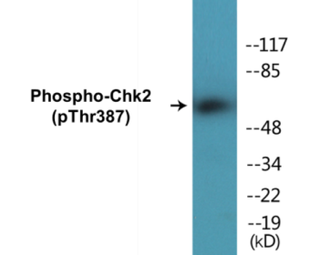 Phospho-Chk2 (Thr387) Colorimetric Cell-Based ELISA Kit