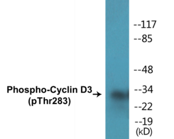 Phospho-Cyclin D3 (Thr283) Colorimetric Cell-Based ELISA Kit