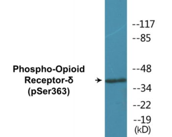 Phospho-Opioid Receptor-delta (Ser363) Colorimetric Cell-Based ELISA Kit