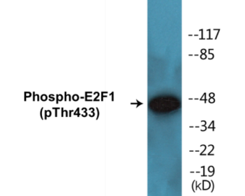 Phospho-E2F1 (Thr433) Colorimetric Cell-Based ELISA Kit