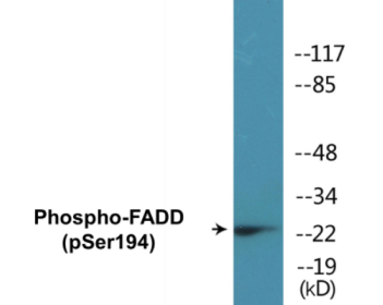Phospho-FADD (Ser194) Colorimetric Cell-Based ELISA Kit