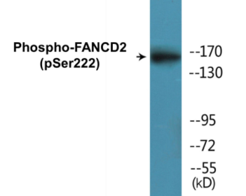 Phospho-FANCD2 (Ser222) Colorimetric Cell-Based ELISA Kit