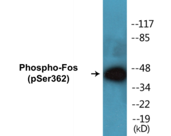 Phospho-Fos (Ser362) Colorimetric Cell-Based ELISA Kit