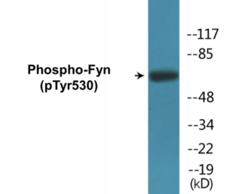 Phospho-Fyn (Tyr530) Colorimetric Cell-Based ELISA Kit