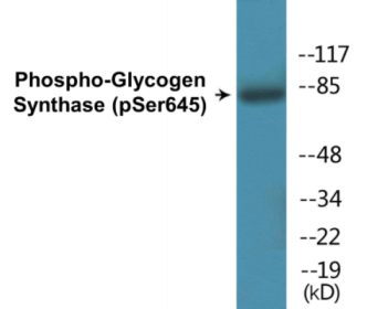 Phospho-Glycogen Synthase (Ser645) Colorimetric Cell-Based ELISA Kit