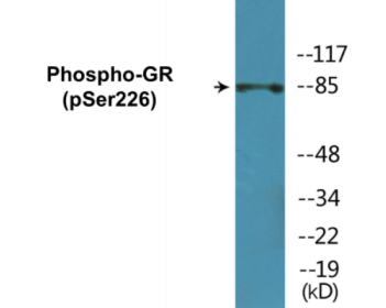 Phospho-GR (Ser226) Colorimetric Cell-Based ELISA Kit