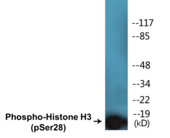 Phospho-Histone H3 (Ser28) Colorimetric Cell-Based ELISA Kit