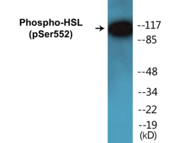 Phospho-HSL (Ser552) Colorimetric Cell-Based ELISA Kit