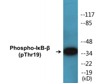 Phospho-IκB-beta (Thr19) Colorimetric Cell-Based ELISA Kit