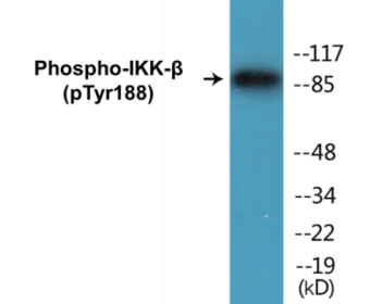 Phospho-IKK-beta (Tyr188) Colorimetric Cell-Based ELISA Kit