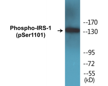 Phospho-IRS-1 (Ser1101) Colorimetric Cell-Based ELISA Kit